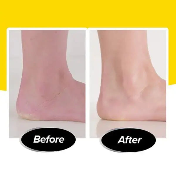 PedEgg PediVac Electric Foot File