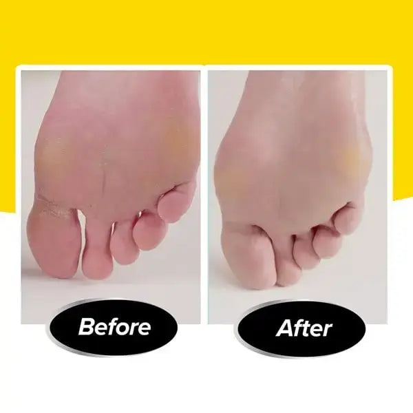 PedEgg PediVac Electric Foot File