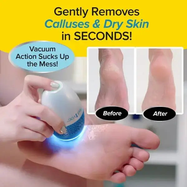 PedEgg PediVac Electric Foot File